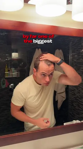 documenting my hair regrowth using @keeps #hairlosstreatment #keeps #hairgrowth 