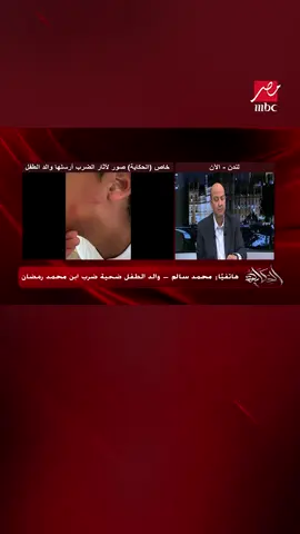 والد الطفل ضحية ابن محمد رمضان: ابني انهار نفسيا وماترباش على السلوكيات دي #الحكاية #MBCMASR