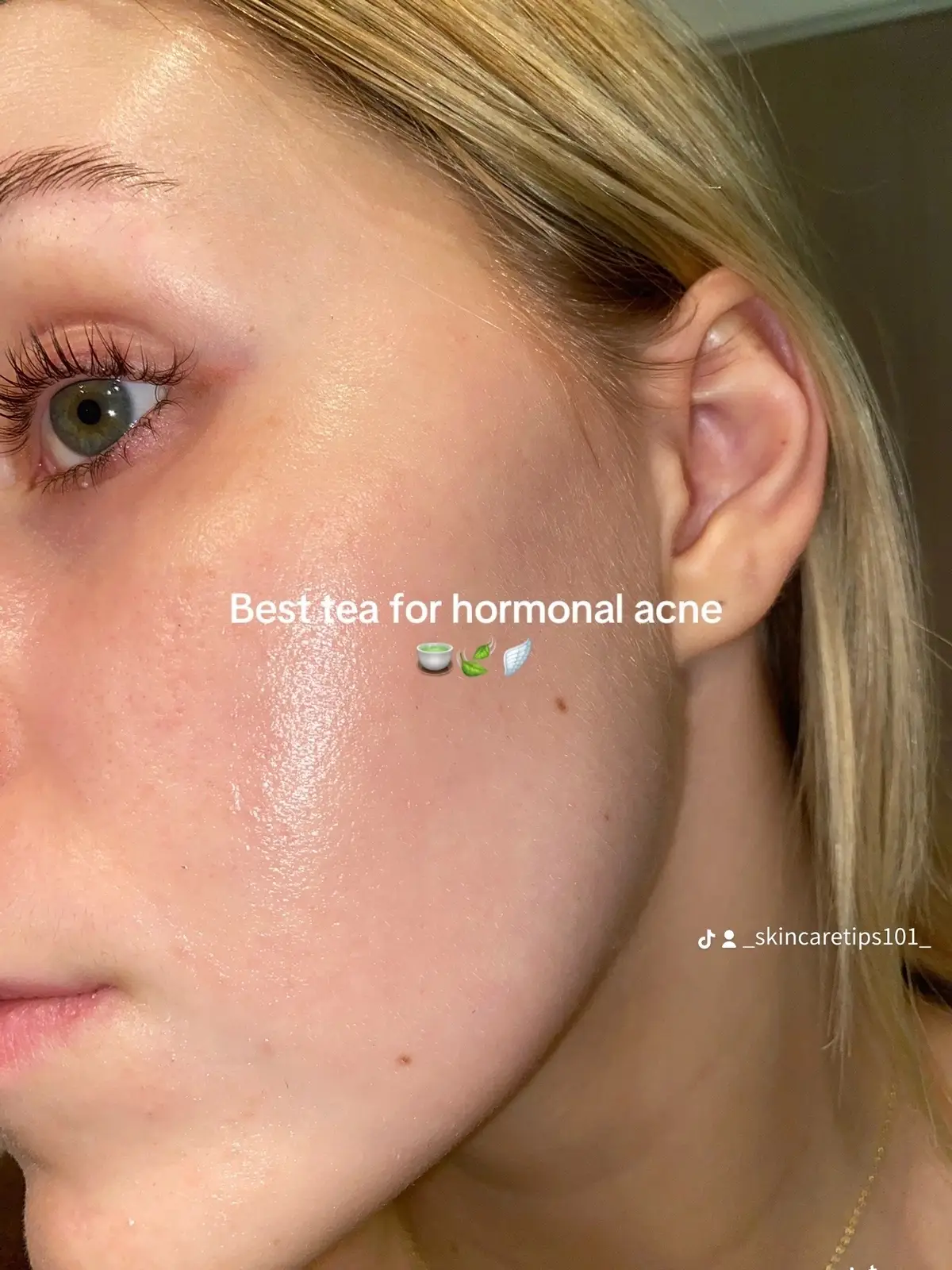 Spearmint tea for hormonal acne> 🍵 #spearmintteabenefits #spearmintteaforacne #bestteaforacne 