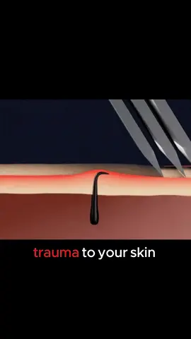 You razor might be damaging your skin! #shavingtips #mensgrooming #womensgrooming #personalcare #ingrownhairtreatment #shaving 