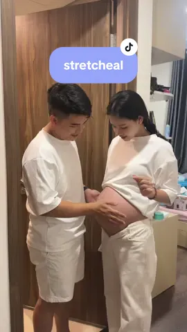 Chấm điểm cho kem rạn với tui nào các mom  #stretcheal #stretchealvietnam 