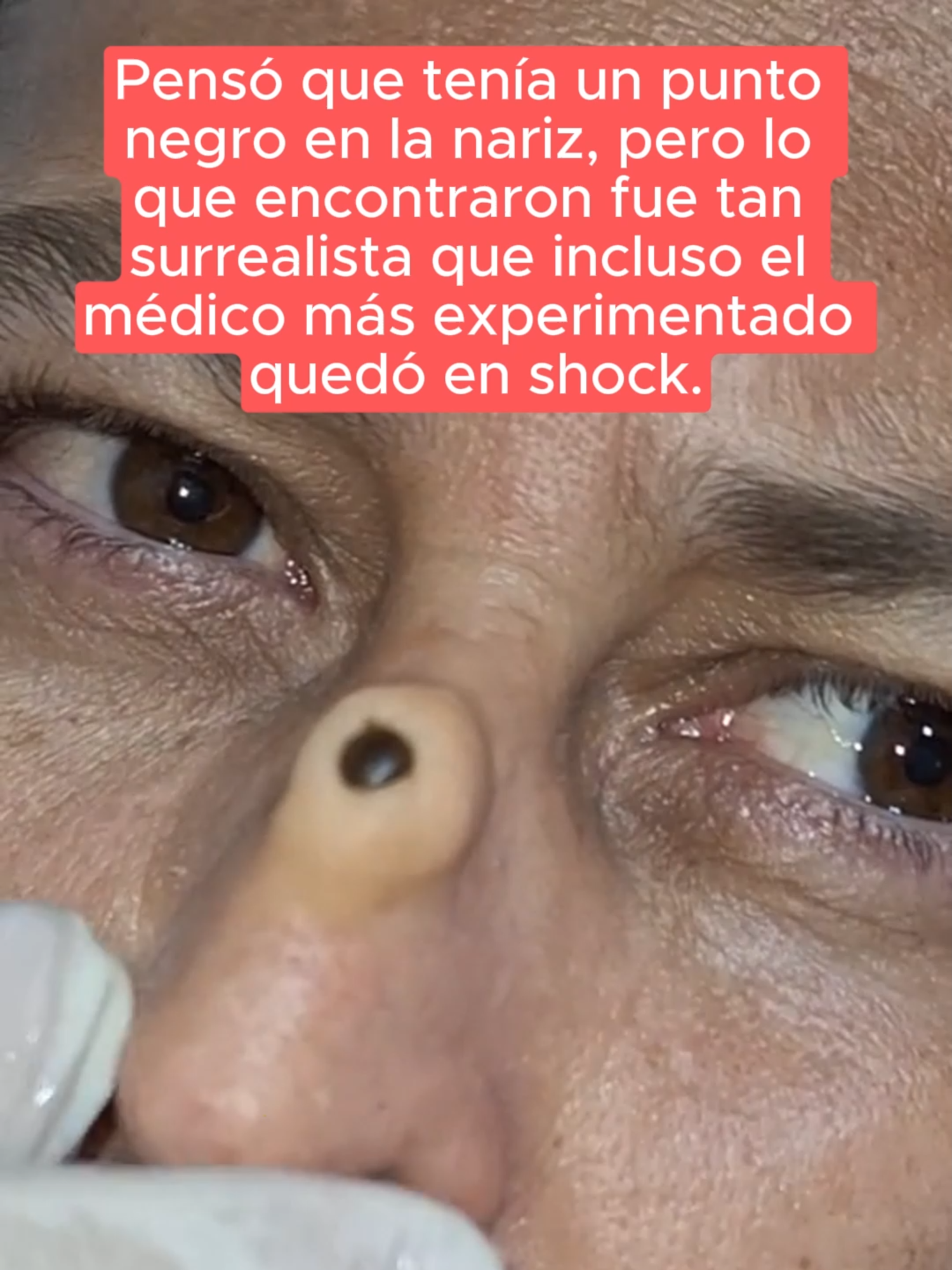 #nariz #nose #medic #historias #historia #caso #misterio #us