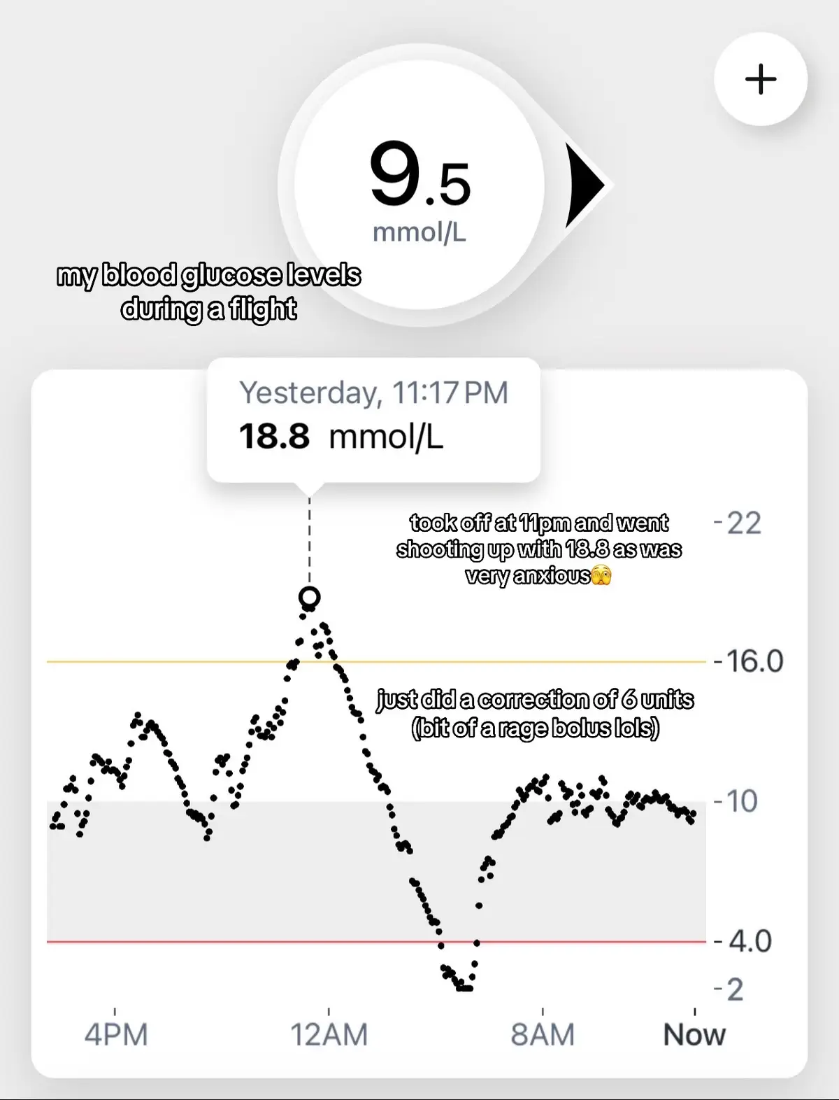 #diabetes #diabetic #type1 #type1diabetes #type1diabetic #t1d #dexcom #dexcomwarrior #dexcomoneplus #cgm #cgmuser 
