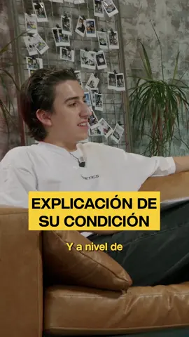 Qué les ocurre exactamente a los siameses #siameses #curiosidades #interesante #latam