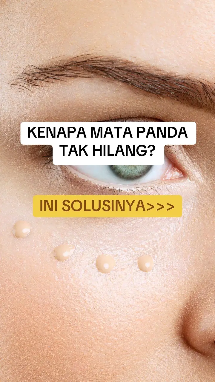 Rahsia bawah mata cerah ✨No more mata panda 🐼🤩 #SKINMADE #skincare #beautyscience #fyp #skintok #skincaretips #skinbarrier #acne #hyperpigmentation #darkspots #sensitiveskin #oilyskin #dryskin #darkcircle #healthyskin #brightening #glowingskincare #brighteningundereyes #tintedsunscreen #mineralsunscreen #vitamincserum #hybridsunscreen #eyeserum 