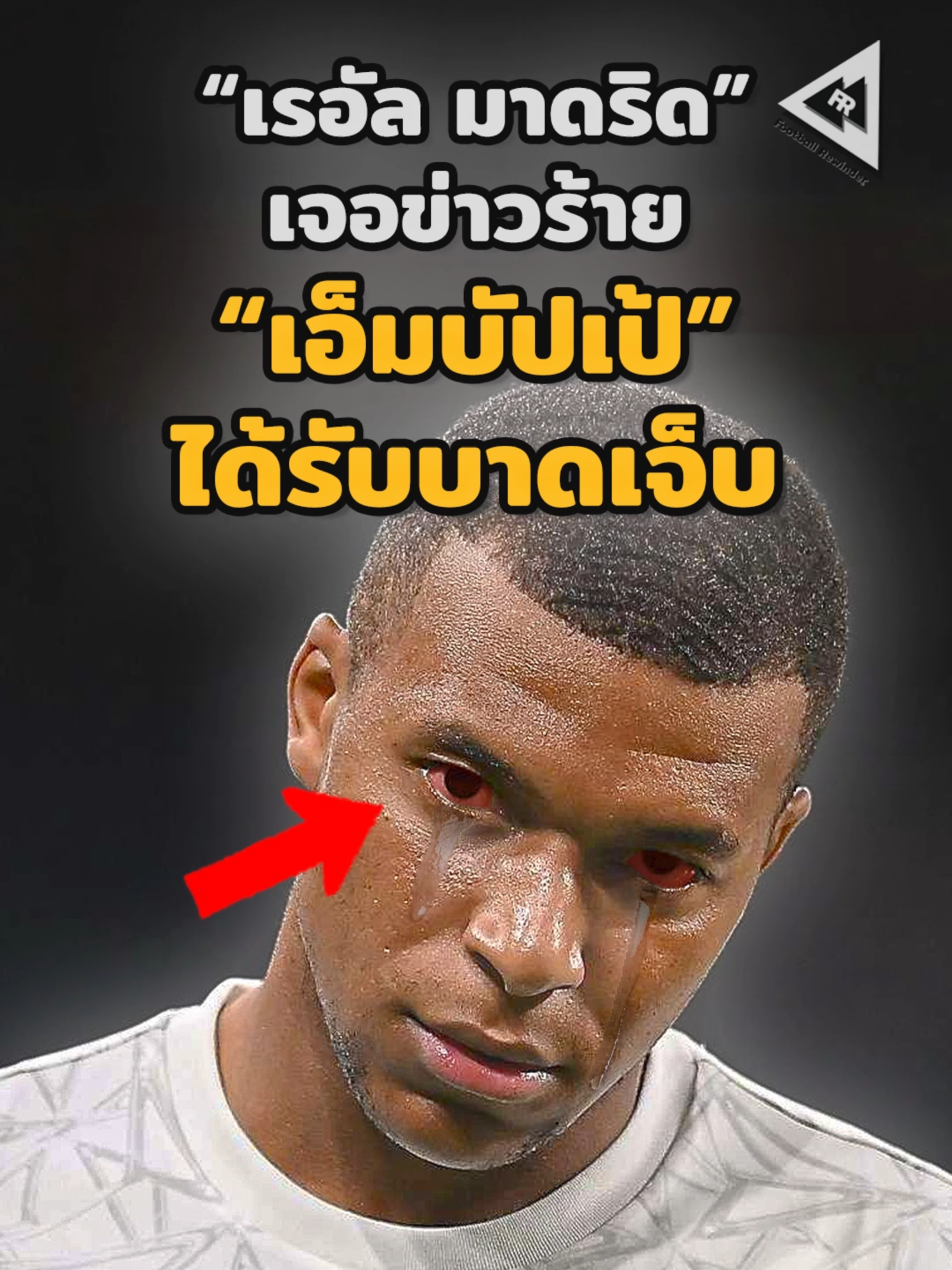 “เรอัล มาดริด”เจอข่าวร้ายเมื่อ“เอ็มบัปเป้”ได้รับบาดเจ็บ🤕 #mbappe #เอ็มบัปเป้ #kylianmbappe #realmadrid #madrid #laliga #คีเลียนเอ็มบัปเป้ #เรอัลมาดริด #มาดริด #ลาลีกา #บาดเจ็บ #injury #injuries #ฝรั่งเศส #เจ็บ #ฟุตบอล #เรื่องเล่า #เรื่องที่คุณอาจไม่รู้ #นักบอล #นักฟุตบอล #คลิปบอล #คลิปฟุตบอล #คุณรู้หรือไม่ #ซอคเกอร์ #บอลนอก #ผลบอล #ผลบอลวันนี้ #วิเคราะห์บอล #วิเคราะห์บอลวันนี้ #พากษ์บอล#football #footballer#Soccer #clipfootball #footballclip #Reels #shorts #Viral #Didyouknow#footballtiktok #soccertiktok #tiktokฟุตบอล #tiktokfootball #tiktokบอลนอก #TikTokUni #รู้จากtiktok #ฟุตบอลtiktok #Tiktokการกีฬา  -------------------------------------------------- ติดต่อโฆษณา Inbox ได้เลยครับ 🙏 (⚽ พาคุณย้อนไปในเรื่องราวฟุตบอล ❤️) #footballrewinder #ฟุตบอลรีไวด์เดอร์ #ฟุตบอลกรอกลับ  I must state that in NO way, shape or form am I intending to infringe rights of a copyright holder. Content used is strictly for research/reviewing purposes and to help educate. All under the fair use law. ⚠️⚠️