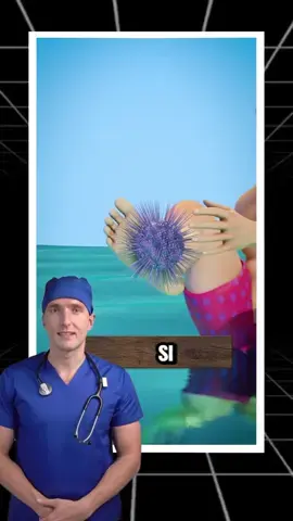 Que Pasaría si Pisas un Erizo de Mar? ⚠️☠️ Sígueme para que sea tu doctor 💙  #erizodemar #seaurchin #espinas #doctorkbron #conocimiento #AprendeEnTikTok #SabiasQue 