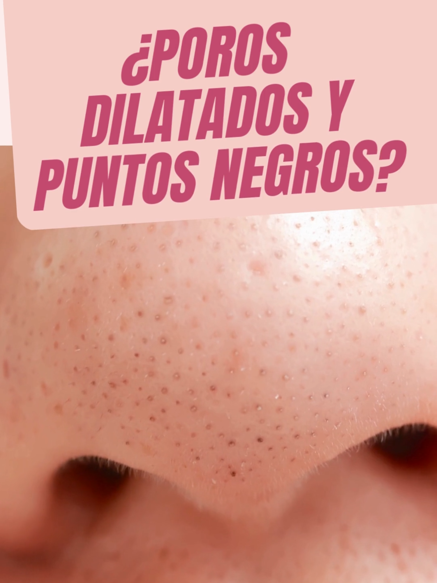 Poros dilatadosy puntos negros. Aquí hay unas recomendaciones para que tus poros estén más limpios y su apariencia mejore.  #skincare #skincareroutine #skincaretips #porosdilatados #minimizadordeporos #marykay #marykaymexico #puntosnegros