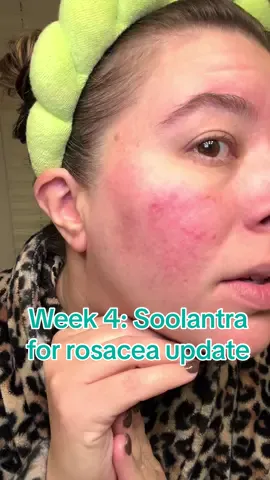 Week four on Soolantra for my rosacea! This week, things seem to be getting a little better, but it seems to be one step forward, and two steps back. #rosacea #soolantra #skincare #over40skincare 