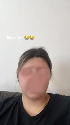 I didnt relaize my wye got stuck 😂  #fyp#facepuzzle#funny#wtf#fypシ  