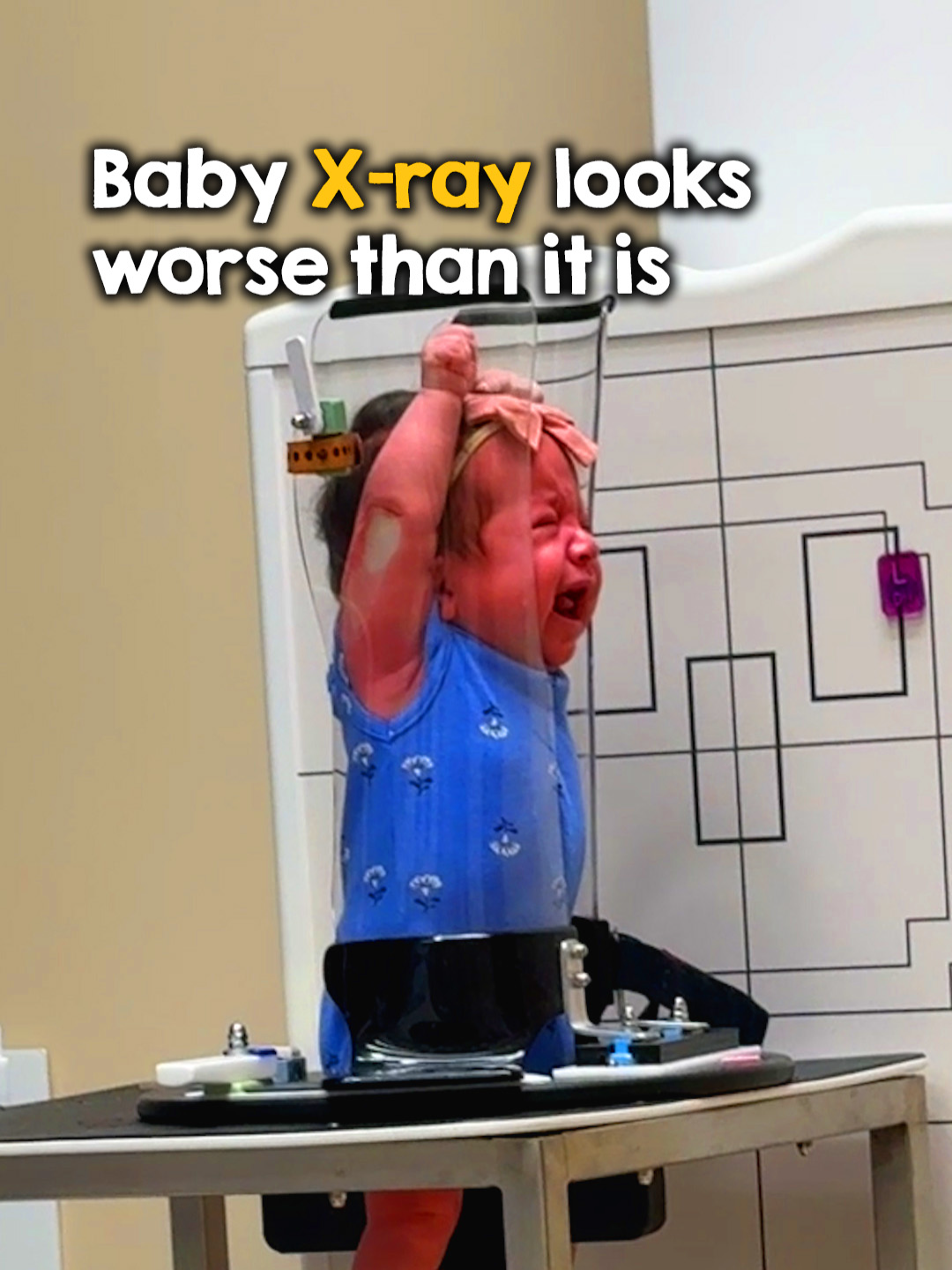 I had No Idea this was how babies were x-rayed #xray #babytiktok