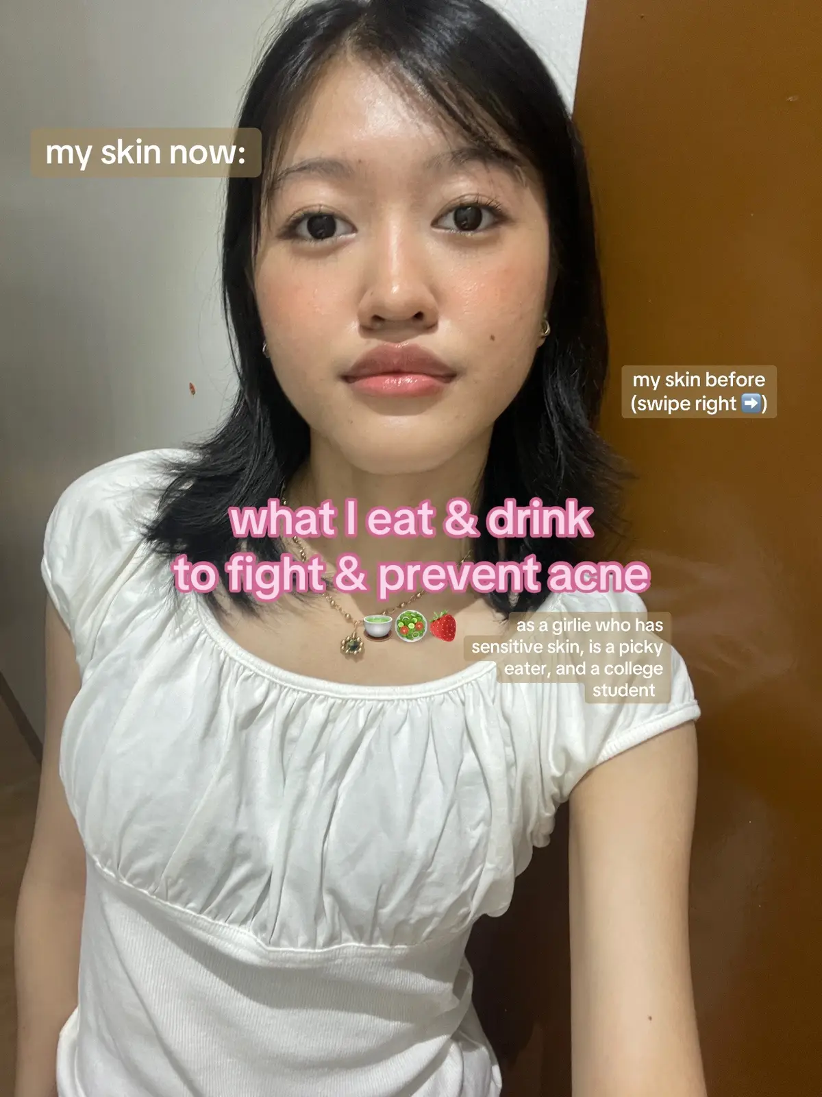 What I've been eating recently to fight acne ~ #antiacne #guthealth #hormoneimbalance #Skincare #Skincaretips #healthyfood #guthealthtiktok #guthealing #hormonalacne #acnetreatment #acnefighter #acnefighter #fyp #foryoupage #antiinflammatorydiet #antioxidants 