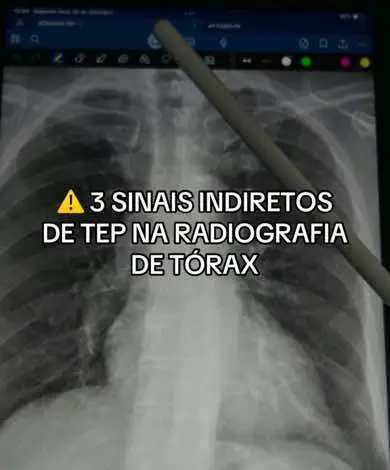 Já salva pra revisar. ☢️ #estudantedemedicina #medicina #radiologia #radiografia 