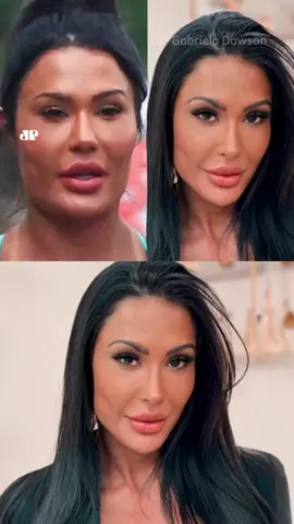 Gracyanne Barbosa surpreendeu seus seguidores ao revelar que removeu os preenchimentos faciais antigos. Neste domingo (29), a musa fitness compartilhou um vídeo mostrando o antes e depois da mudança e explicou que está em busca de um visual mais natural e equilibrado. “Nos últimos meses, tenho me focado em encontrar o equilíbrio, e com a estética não foi diferente. Decidi remover todos os produtos que usava no rosto e aplicar alguns apenas em pontos estratégicos de embelezamento, de uma maneira mais natural, com tecnologia de ponta e procedimentos pontuais”, escreveu Gracyanne na legenda. No final, comemorou a mudança e disse estar encantada com o resultado. E você, curtiu a mudança de visual? 🎥Reprodução: Instagram/graoficial 📺 Confira na JP News e Panflix #JovemPanEntretenimento #GracyanneBarbosa #Preenchimento
