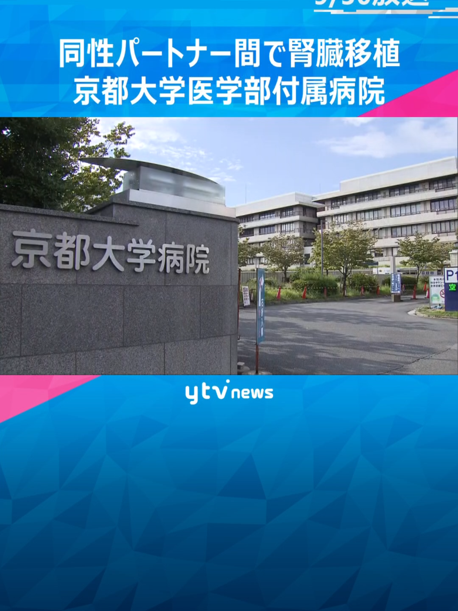 京都大学医学部付属病院は、同性パートナーをドナーとする腎臓の移植を行ったと発表しました。腎臓の移植を受けたのは慢性腎不全を患った京都市内に住む女性です。#tiktokでニュース #読売テレビニュース