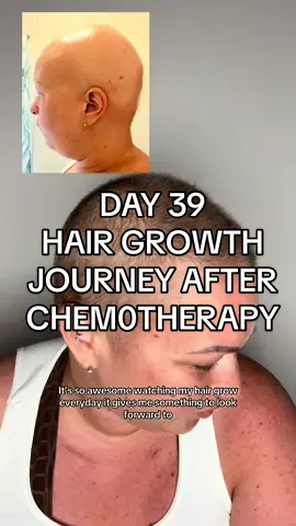 Day 39, hair journey after chem0 #hairgrowth #hairgrowthtips #hairgrowthjourney #hairtok #maryruthsorganics 