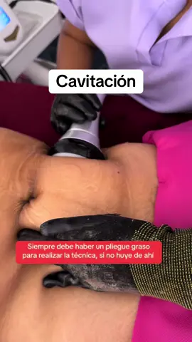 Cavitación, una técnica que genera rompimiento de la membrana de la célula grasa y que por ello debe hacerse con profesionales para cuidar de tu salud ##cavitacion #puebla #fisioterapia 