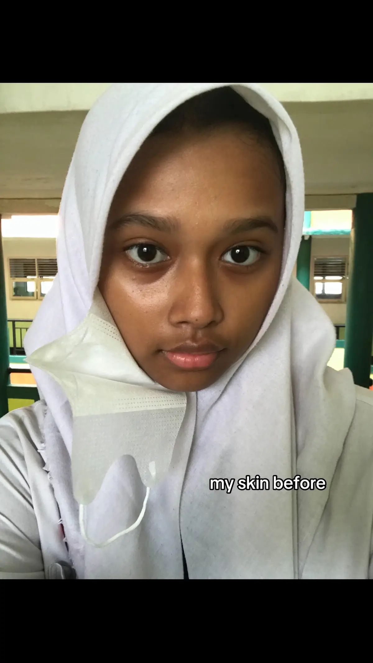 pernah sampe di fase dapet julukan black mamba wkwk #xyzbca #fyppppppppppppppppppppppp #skincareroutine #rekomendasi #forupage #beranda #trending #berandatiktok #schoolair #4u 