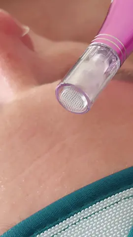 Transform your salon with Booster Therapy using the Nano Needling System! 🌟 This advanced treatment revitalizes skin, reduces fine lines, and enhances overall texture with minimal downtime. Perfect for attracting new clients and elevating their experience. Ready to boost your services? #solution #dermapen #nanoneedling #beautytherapist #solution #proffesional #treatment #beauty #qualified #skineffect #salon #clientes #foryourbusiness #christchurchnz #nz #new 
