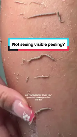 What to do if you're not seeing any visible peeling🤭 #exfoliateyourskin #bodycareroutine #deadskinremover #smoothskin 