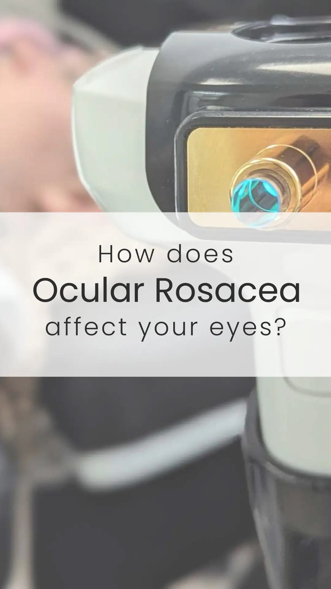 Ocular rosacea can cause redness, inflammation, and dry eyes that leave you feeling uncomfortable and irritated. It’s more than just a little eye redness—without proper care, symptoms can worsen and lead to long-term discomfort. Keeping up with a consistent eye care routine is key to managing these symptoms and protecting your eyes from further issues. #IslandEyecare #Lumeccai #InMode #OcularRosacea #EyeHealth #DryEyes #EyeCare #RosaceaAwareness #HealthyEyes #EyeIrritation #Inflammation #VisionCare #ProtectYourEyes 