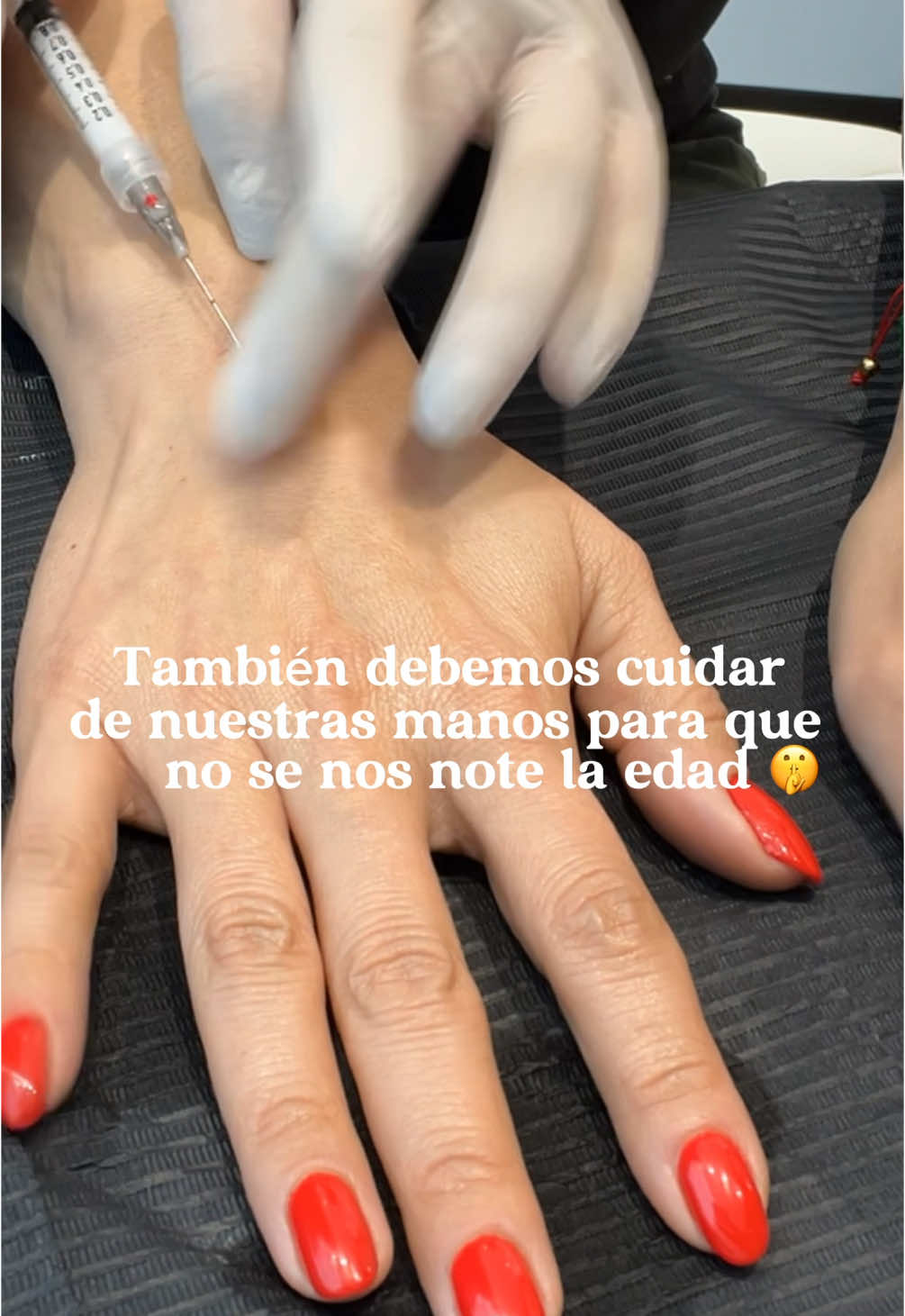 Devuélvele a tus manos la juventud que merecen. ✨ Descubre los secretos para unas manos radiantes y renovadas. #RejuvenecimientoDeManos #bioestimuladordecolageno #radiesse #sculptra #hialuronico 