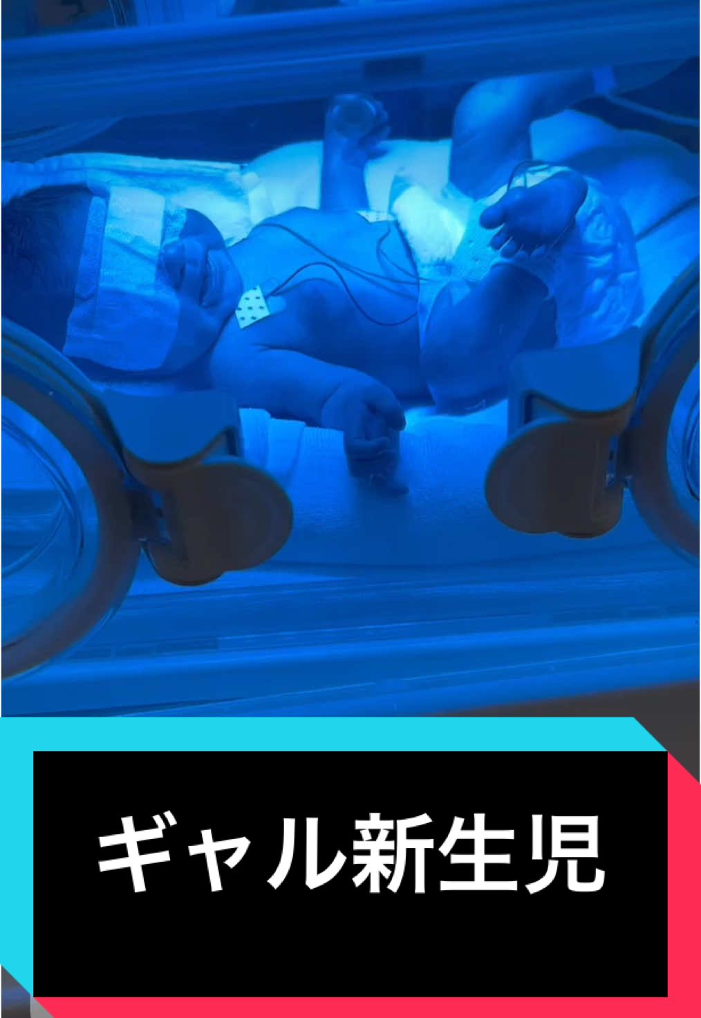 ギャル赤ちゃん👶 集中治療室の日焼けサロン #日焼けサロン #シェアボイス #新生児のいる生活 #新生児パパ #新生児パパ 