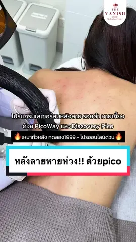 #เลเซอร์ลบหลังลาย #หลังลาย #รอยสิวที่หลัง #หลัง #picolaser #picowaylaser #discoverypico #thevanishclinicตัวจริงเรื่องเลเซอร์ #thevanishศูนย์รวมเลเซอร์อันดับ1 #cutegirl_thevanish #thevanishfitcheck #thevanishclinic #เดอะเเวนิชคลินิก #รีวิวบิวตี้ในtiktok #รีวิวบิวตี้ 
