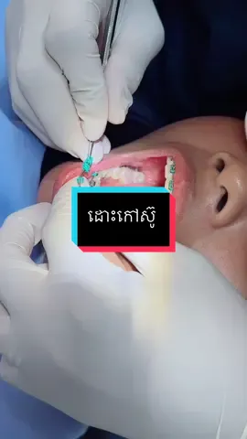 Check up ដូរកៅស៊ូ #braces #ព្យាបាលធ្មេញ #teamធ្មេញដែក #គ្លីនិកធ្មេញគ្រេតស្មាល #fyp #greatsmiledentalclinic 