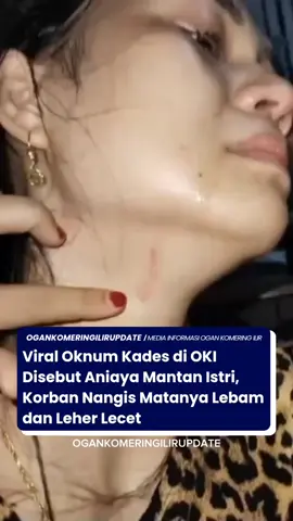 Viral video tangis seorang wanita yang wajahnya babak belur disebut akibat dianiaya mantan suaminya. Dari kabar beredar, disebutkan mantan suami wanita ini adalah kepala desa (Kades) di Kabupaten Ogan Komering llir (OKI), Sumatera Selatan (Sumsel).  Dalam video berdurasi 16 detik yang beredar, Senin (7/10/2024), nampak mata sebelah kirim wanita ini bengkak dan lebam membiru. Di lehernya, dagu dan pipinya juga terdapat luka lecet.  sumber : tribunsumsel.com #ogankomeringilirupdate #ogankomeringilir #tiktokberita #beritatiktok 
