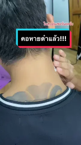 ตอบกลับ @nineeyanineee ลองเปิดใจใช้ดูครับ🥰✨  #เรตินอล #เรตินอลทาคอ #คอดํา #คอเหี่ยว 