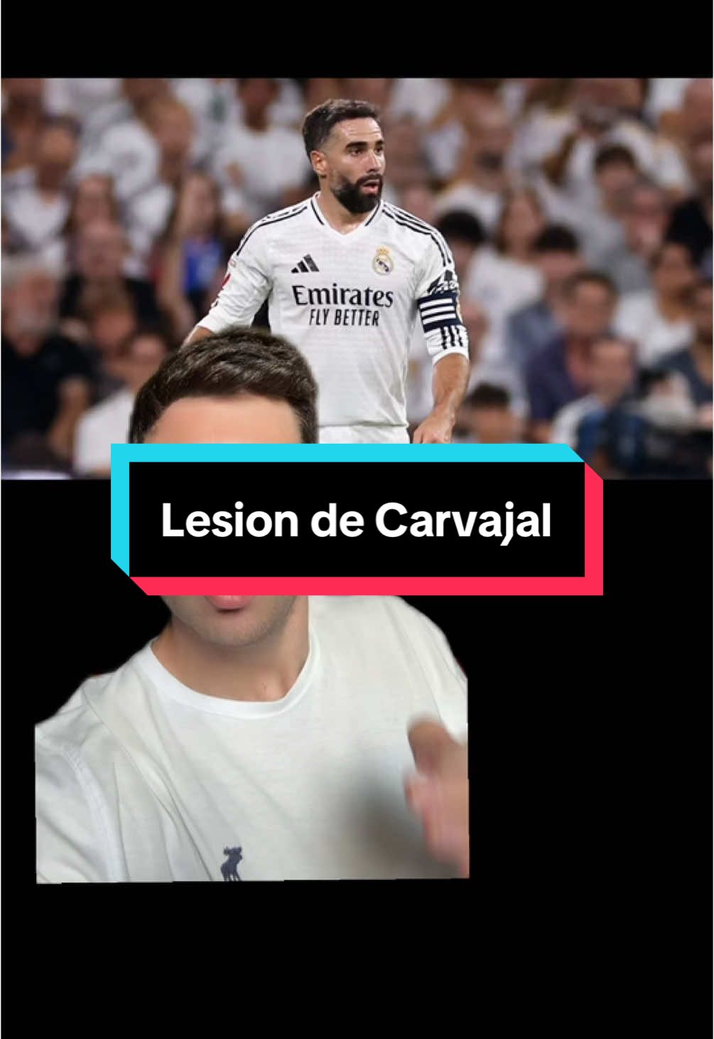 GESTOS QUE MARCAN MA DIFERENCIA 🙌🏻🙌🏻🙌🏻🙌🏻🙌🏻🙌🏻🙌🏻🙌🏻🙌🏻 #futbol #realmadrid #carvajal #lesion #elogio #opinion #viral #greenscreen #fyp