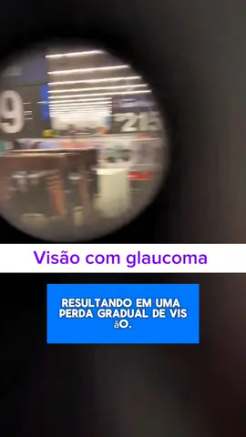 Visão de glaucoma #glaucoma #visao #oculos #otica 
