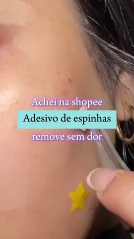 Adesivos de estrelinha que secam e removem a espinha sem dor!! 💖 #skincare #skincareroutine #espinha #cuidados #achadinhos #achadosshopee 