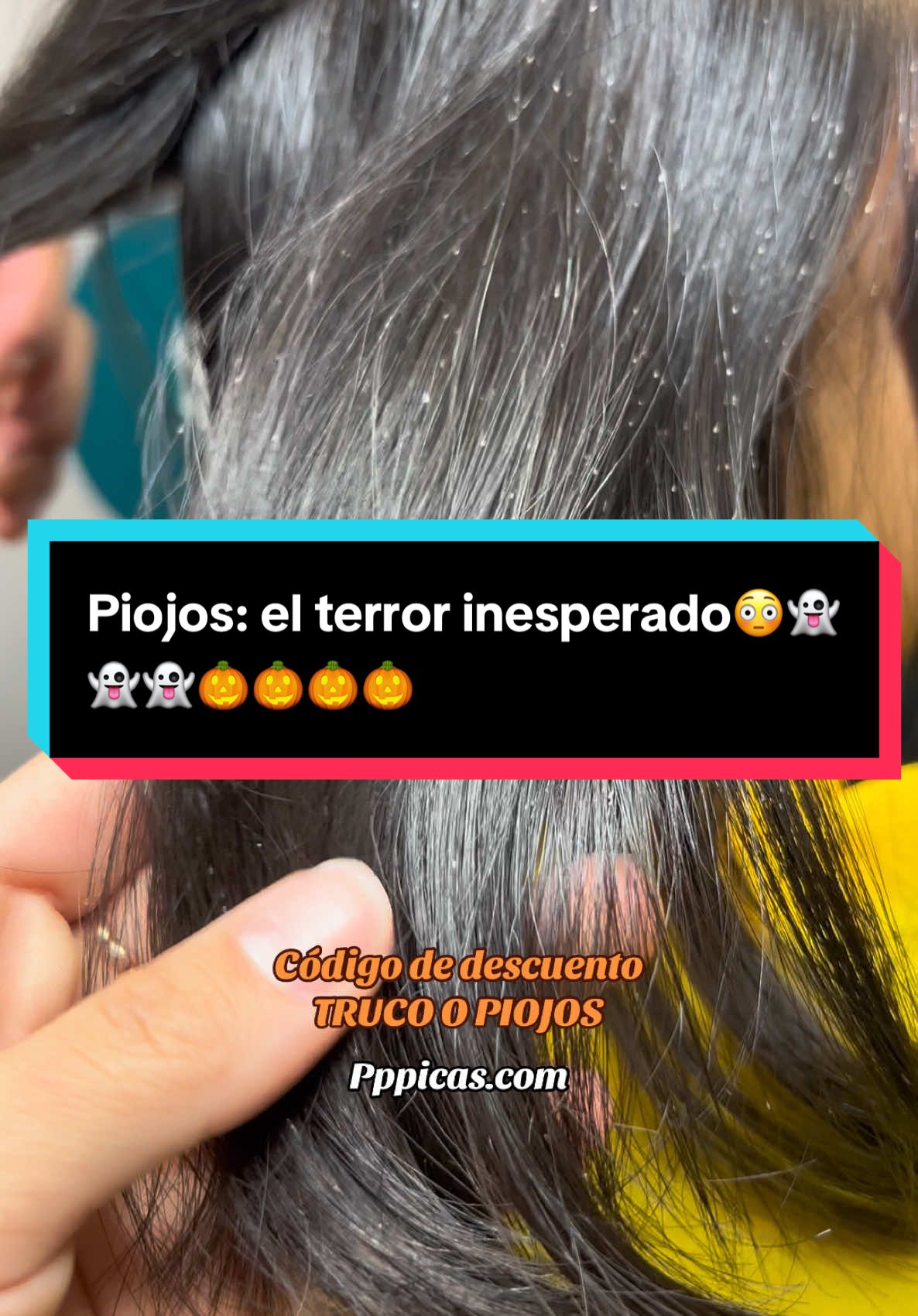 #piojos el terror inesperado de todos los #papás 🎃👻👻 10%off en Kit y pack y 2x1 en Liendreras📣📣🛒 válido en tienda online🛒 pppicas.com 🇲🇽🇲🇽🇲🇽  📍Sucursal:Xalapa yPuebla  #piojos #papás #piojosyliendres #pediculosis #puebla #xalapa #storytime #estetica #sonpiojos #halloween2024 #tienesqueverlo 