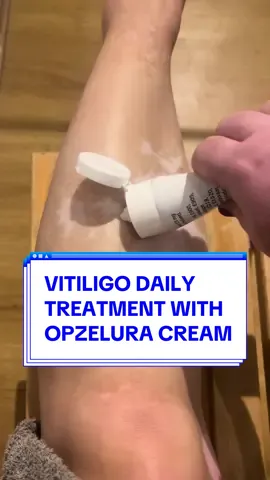 Traitement du vitiligo avec la crème Opzelura 💊 - Motivation quotidienne                       ° ° ° ° #opzeluracream #DailyRoutine #routine #dailyroutinemotivation #opzelurajourney #medicine #vitiligocheck #vitiligomedication  #vitiligo #vitiligogirl #vitiligobeauty #vitiligotreatment #vitiligotransformation #vitiligotraitement #depigmentation #depigmentationtreatment #skinproblem #vitiligofrance #vitiligoworld #opzelura #viral #autoimmunedisease #maladiechronique #autoimmunedisorder #autoimmune #foryou #pourtoi #pourtoii #fyp #parati #skinproblems #enfermedadautoinmune #enfermedadescronicas #enfermedadesraras #enfermedad #enfermedades #pour #pourtoipage #pourtoiii #pourtoiiiii #fypp #fypシ゚ #paratii #paratiiii #ruxolitinib #whitepatches #skincondition #vitiligoprogression #explorer #tendance #maladie #sante #espoir #combat #medical #france #skincare #skincareroutine #skincareroutinevitiligo 
