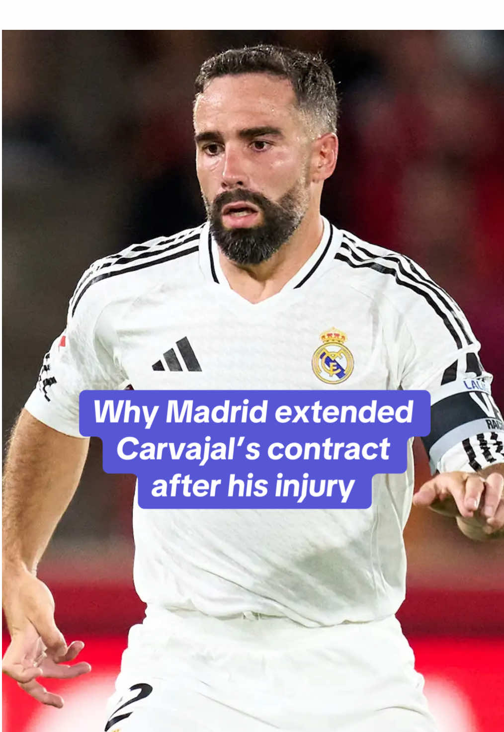 A classy move from Real Madrid 🥹 #realmadrid #carvajal #injury #football #Soccer 