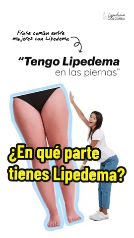😬 El motivo por el cual el tratamiento conservador para el Lipedema contempla varias aristas es sencillo: porque el Lipedema al ser una condición multi-factorial implica ser abordado la desde varios flancos. Sé que es dificil empezar a verlo diferente cuando en todas partes escuchas hablar de la grasa y su ubicación en el cuerpo. Pero, esta condición no es solo grasa. 😐 En el Lipedema entran en juego varios factores y componentes: Está la parte hormonal, el sistema vascular y linfático, el factor genético, los estrógenos, el tejido conectivo laxo y el colágeno.  ¡Y esto es hasta ahora lo que sabemos! Tu Lipedema no va a cambiar si lo sigues viendo solo desde el punto de vista estétito o desde lo que se puede percibir. La alteración del sistema debido a esa inflamación crónica va a variar de persona a persona y por ende, el tratamiento debe ser individualizado.  El Lipedema no está en tus piernas o en tu brazos, solamente…está en tu organismo y es un mecanismo que debes empezar a conocer, a aprender a vivir con él.  No tiene cura, sí tratamiento, y se pueden lograr cambios muy positivos a nivel externo e interno.  #lipedema #lipedemacolombia #lipoedema #lippysister #pernas #celulitis