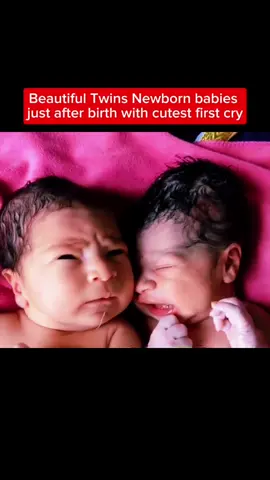 #newbornbaby #newborn #baby #babykids #birth #twins #kids #babylove #Love #babymama #viral #foryou