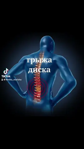 ГРЫЖА ДИСКА позвоночного столба #грыжадискалечение #межпозвоночнаягрыжаодесса #лечениегрыжипозвоночникаодесса #лечениегрыжипозвонков 