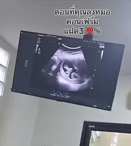 ตื่นเต้นทั้งคลินิก ตอนคุณหมอคอนเฟิร์มว่าแฝด3คน ส่วนพ่อพ่อถ่ายคลิปไว้ มือสั่นเลย😂 ตื่นเต้น ดีใจ เพราะตอนตรวจครั้งแรกยังไม่เชื่อว่าเป็นแฝด #ทะลุหมัน #แฝดสามธรรมชาติ 
