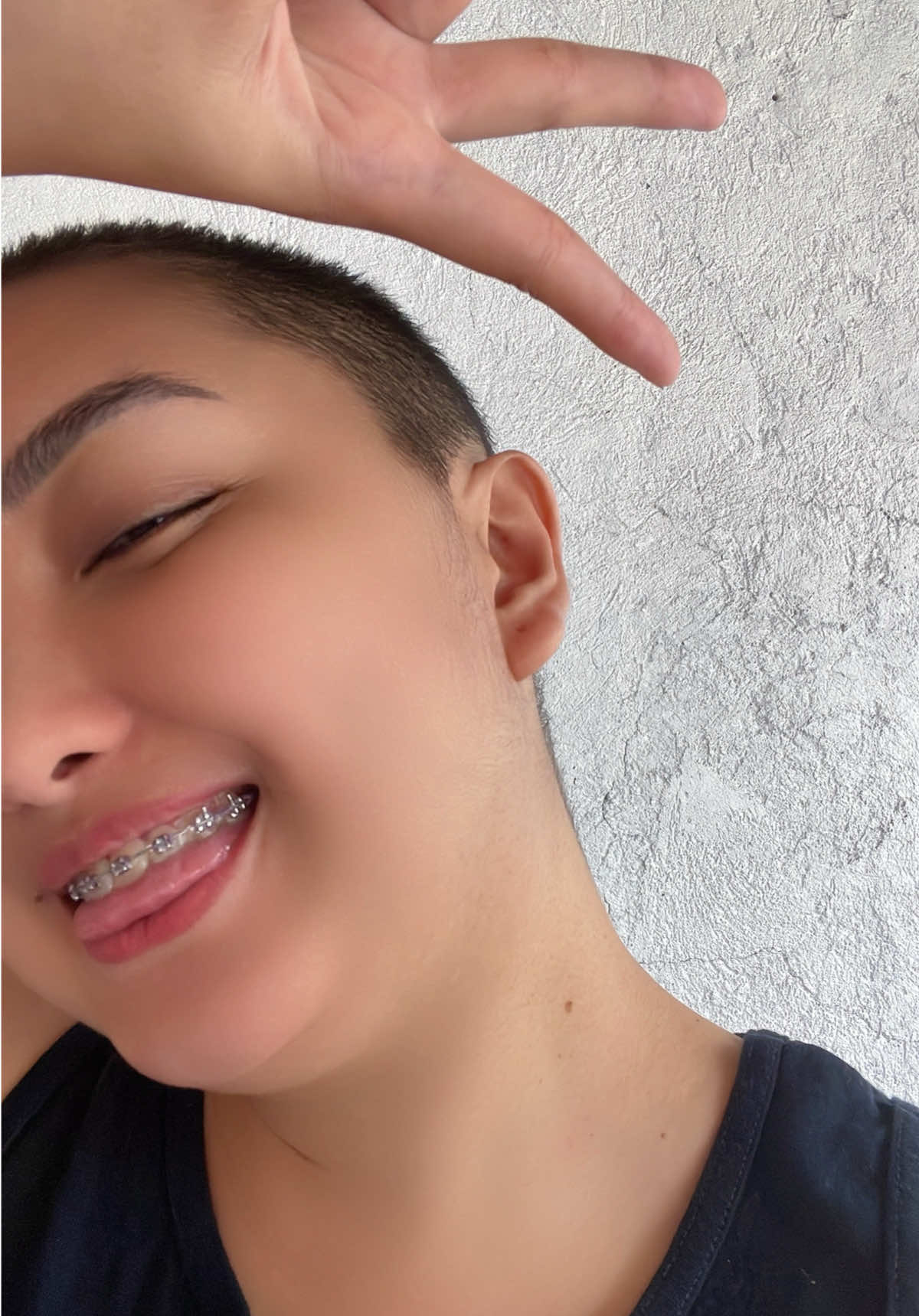 My journey from long hair to short hair to boy cut then now semi bald. Inspired by @Ms. Ryza Cenon 🥰