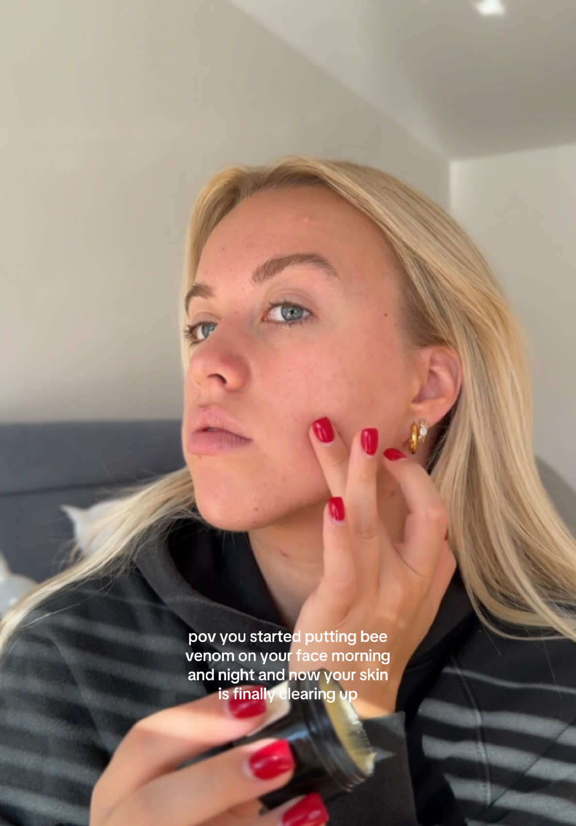 It’s not oerfect but getting there!!! #beevenom #beevenomskincare #acneskin #acneproneskin #breakouts #skincarehacks 