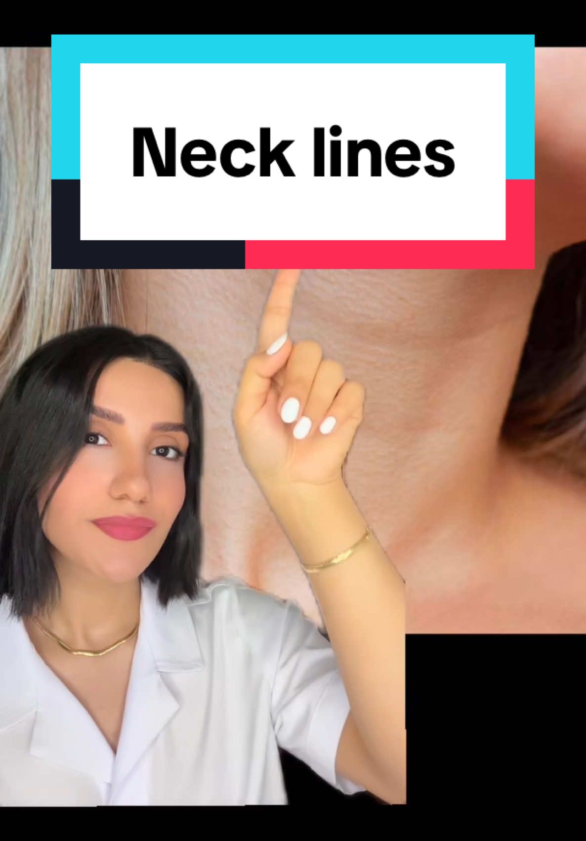 Neck lines and wrinkles are a normal part of aging. They're caused in part by skin losing elasticity and being exposed to UV light over time. Hydrating the skin will help it look plump, so wrinkles are less visible, and it can also help prevent future creases from forming. #wrinkles #finelines #antiaging #neckline 