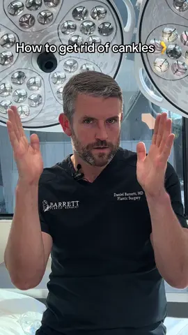 How to get rid of cankles #cankles #plasticsurgeonsoftiktok #doctorsoftiktok 
