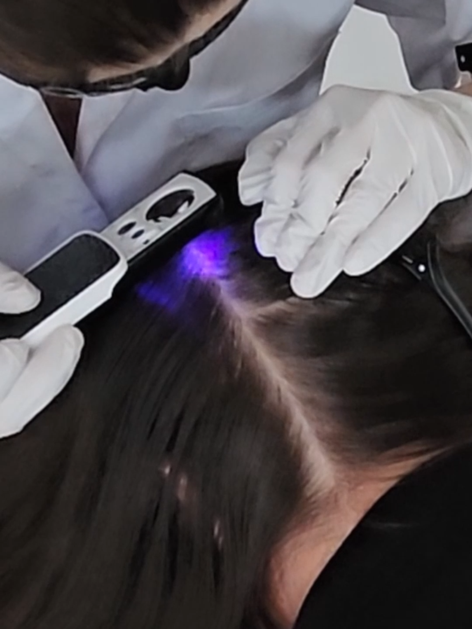 ASMR Examining Sensory LOSS on her SCALP | Satisfying Scalp Check & Combing (Real Person) #asmr #asmrsounds #asmrvideo #asmrtiktoks #scalp #scalpcheck #asmrsensory #asmrroleplay #asmrmedical