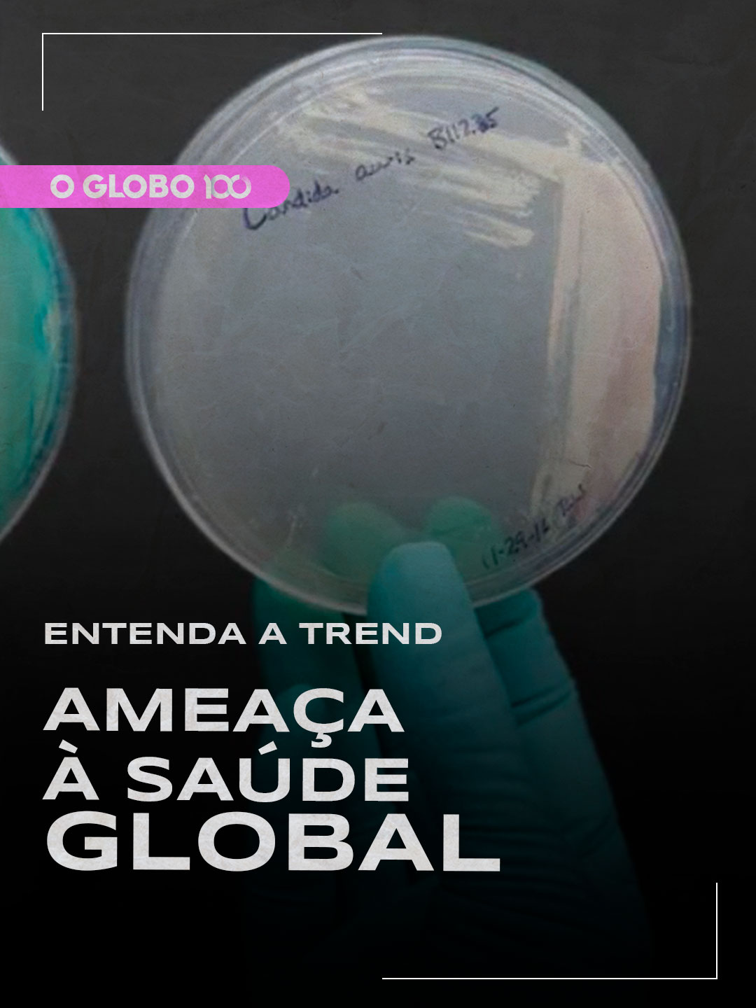 🗣 ENTENDA A TREND | Ameaça à saúde global    Candida auris é um microrganismo que está gerando um alerta em autoridades de saúde por ser resistente aos medicamentos tradicionais. Estimativas apontam que de 30% a 60% dos contaminados morrem em decorrência da doença. Mas a razão para a alta letalidade é que as pessoas infectadas também estão lidando com vários outros problemas de saúde.  Aperta o play para entender!   #EntendaaTrend é um quadro nas redes sociais do #JornalOGlobo para você ficar por dentro dos assuntos que estão bombando na internet