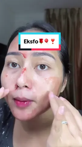 Hati hati ya pake moist abis eksfoliasi, jangan yang ada kandungan aktif nya, pake yang moist ungu g2g