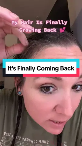 My Hair Is finally growing back! I'd lost over 40 lb very very quickly and my hair also went with it.. and I've been trying to get it back for so long.. finally found something that worked for me! #hollywood #viralhairgrowthoil #hair #thinkingabout #thinhair #tiktokmademebuyit #beauty #tiktokshop #resultsmayvary #allnatural 