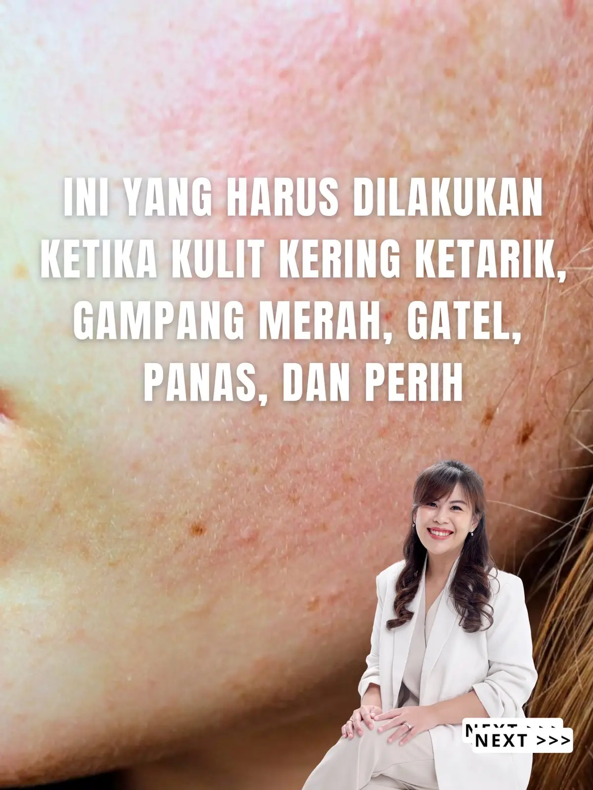 Siapa yang lagi mengalami hal ini? 😞 #edukasiskincare #tipsskincare #skinbarrier 